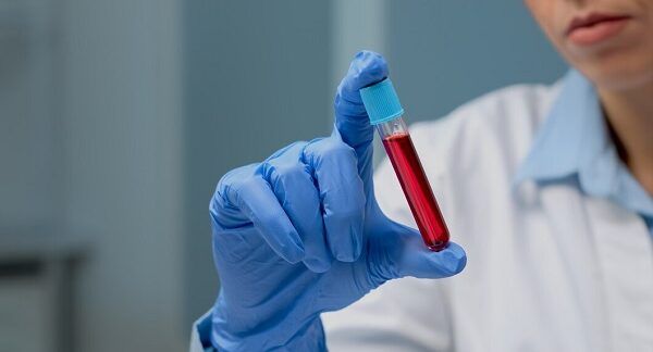 Top 10 des services d'hématologie à Paris